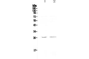 Western blot analysis of Kallikrein 6 using anti-Kallikrein 6 antibody . (Kallikrein 6 Antikörper  (AA 22-244))