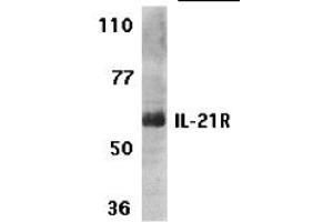 Western Blotting (WB) image for anti-Interleukin 21 Receptor (IL21R) (N-Term) antibody (ABIN1031410) (IL21 Receptor Antikörper  (N-Term))