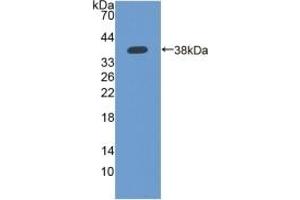 Detection of Recombinant IFI35, Human using Polyclonal Antibody to Interferon Inducible Protein 35 (IFI35) (IFI35 Antikörper  (AA 2-286))