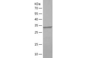 Western Blotting (WB) image for Insulin Receptor Substrate 2 (IRS2) (AA 1035-1136) protein (His-IF2DI Tag) (ABIN7123447) (IRS2 Protein (AA 1035-1136) (His-IF2DI Tag))