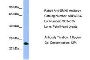 Image no. 1 for anti-Survival of Motor Neuron 1, Telomeric (SMN1) (C-Term) antibody (ABIN6749972) (SMN1 Antikörper  (C-Term))