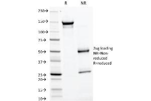 SDS-PAGE Analysis Purified GP2 Mouse Monoclonal Antibody (GP2/1805). (GP2 Antikörper  (AA 35-179))