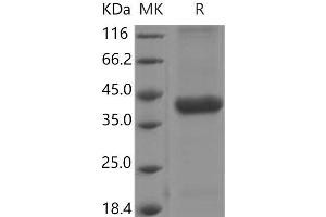 Western Blotting (WB) image for Cathepsin H (CTSH) (AA 21-333) protein (His tag) (ABIN7194680)