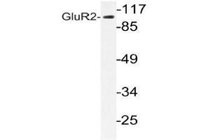 Western blot analysis of GluR2 antibody in extracts from HUVEC cells. (GRIA2 Antikörper)