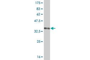 Western Blot detection against Immunogen (36. (ABL2 Antikörper  (AA 743-842))