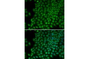 Immunofluorescence (IF) image for anti-Polymerase (RNA) I Polypeptide C, 30kDa (POLR1C) (AA 1-200) antibody (ABIN3020841) (POLR1C Antikörper  (AA 1-200))