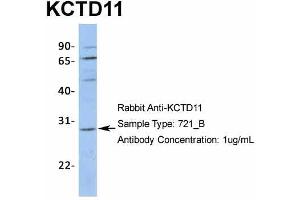 Host:  Rabbit  Target Name:  KCTD11  Sample Type:  721_B  Antibody Dilution:  1. (KCTD11 Antikörper  (N-Term))