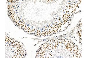 ABIN7094832 and ABIN7098883 at 1/100 staining Rat testis tissue by IHC-P.