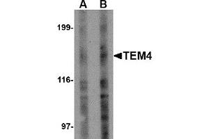Western Blotting (WB) image for anti-rho Guanine Nucleotide Exchange Factor (GEF) 17 (ARHGEF17) (Middle Region) antibody (ABIN1031118)