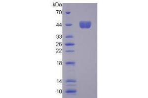 Image no. 1 for Colony Stimulating Factor 2 (Granulocyte-Macrophage) (CSF2) (AA 19-141) (Active) protein (His tag,GST tag) (ABIN6239735)