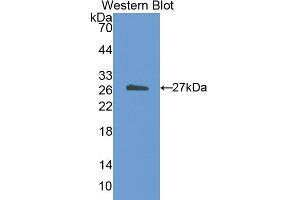 Western blot analysis of the recombinant protein. (CETP Antikörper  (AA 81-311))