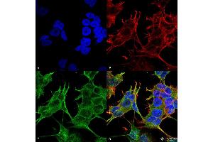 Immunofluorescence (fixed cells) (IF/ICC) image for anti-Glutamate Receptor, Ionotropic, N-Methyl D-Aspartate 2a (GRIN2A) (AA 75-325) antibody (ABIN1686638)
