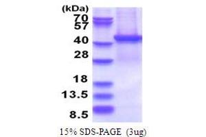 SDS-PAGE (SDS) image for Proteasome (Prosome, Macropain) 26S Subunit, Non-ATPase, 13 (PSMD13) (AA 1-376) protein (His tag) (ABIN5853736) (PSMD13 Protein (AA 1-376) (His tag))