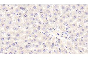 Detection of NOX3 in Rat Liver Tissue using Polyclonal Antibody to Nicotinamide Adenine Dinucleotide Phosphate Oxidase 3 (NOX3) (NOX3 Antikörper  (AA 221-466))