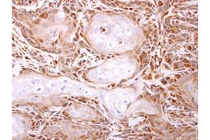 IHC-P Image ITPase antibody [N1C3] detects ITPase protein at cytosol on Ca922 xenograft by immunohistochemical analysis. (ITPA Antikörper)