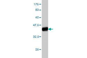 Western Blot detection against Immunogen (37. (ITGA4 Antikörper  (AA 98-207))