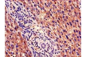 Immunohistochemistry (IHC) image for anti-Proteasome (Prosome, Macropain) Subunit, beta Type, 5 (PSMB5) (AA 106-188) antibody (ABIN7164982)