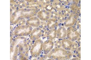 Immunohistochemistry of paraffin-embedded Mouse kidney using CARD10 Polyclonal Antibody at dilution of 1:100 (40x lens). (CARD10 Antikörper)