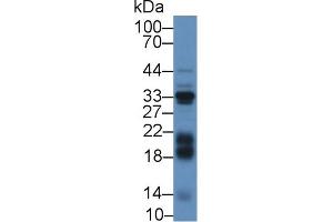 Detection of IGFBP3 in Mouse Liver lysate using Polyclonal Antibody to Insulin Like Growth Factor Binding Protein 3 (IGFBP3)