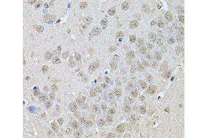 Immunohistochemistry of paraffin-embedded Mouse brain using DR1 Polyclonal Antibody at dilution of 1:100 (40x lens). (DR1 Antikörper)