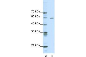 WB Suggested Anti-ARID3A Antibody Titration:  0. (ARID3A Antikörper  (Middle Region))
