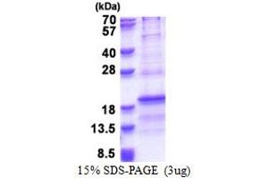 SDS-PAGE (SDS) image for Ribosomal Protein L31 (RPL31) (AA 1-125) protein (His tag) (ABIN6387333)