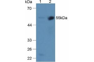 Western blot analysis of (1) Mouse Liver Tissue and (2) Mouse Kidney Tissue. (alpha 2 Antiplasmin Antikörper  (AA 340-491))
