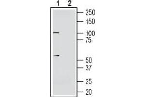 Western blot analysis of human  neuroblastoma cell line lysate:1. (Solute Carrier Family 30, Member 10 (SLC30A10) Peptid)
