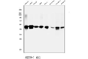 Western blot analysis of RCC1 using anti-RCC1 antibody (ABIN7600024).