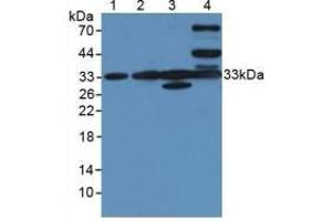 Figure. (CLIC1 Antikörper  (AA 79-241))