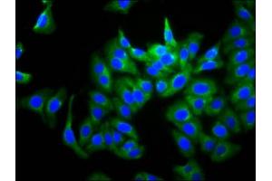 Immunofluorescence staining of HepG2 cells with ABIN7167772 at 1:266, counter-stained with DAPI. (GUCY2D Antikörper  (AA 362-462))
