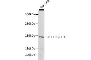 Western blot analysis of extracts of Rat lung, using VEGFR3/FLT4 antibody (ABIN6130779, ABIN6140698, ABIN6140701 and ABIN6217251) at 1:1000 dilution. (FLT4 Antikörper  (AA 1174-1363))