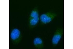 IF analysis of Bcl-XL using anti-Bcl-XL antibody (ABIN5518741).