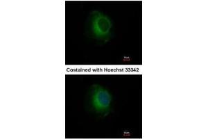 ICC/IF Image Immunofluorescence analysis of methanol-fixed HeLa, using Plasminogen, antibody at 1:500 dilution. (PLG Antikörper)