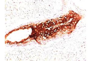 Immunohistochemistry (IHC) image for anti-Keratin 17 (KRT17) antibody (ABIN6939923)