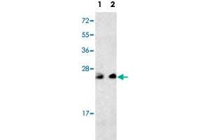 Western blot analysis of multiple cells cell lysate (35 ug/lane) with PTP4A3 polyclonal antibody . (PTP4A3 Antikörper  (C-Term))