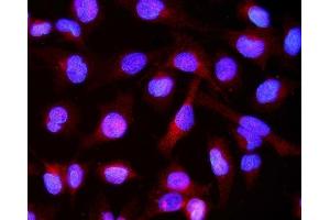 IF analysis of Alpha B Crystallin/CRYAB using anti-Alpha B Crystallin/CRYAB antibody (ABIN7601209). (CRYAB Antikörper  (AA 30-151))