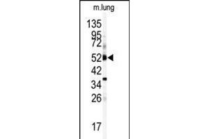 Western Blotting (WB) image for anti-Cytochrome P450, Family 1, Subfamily A, Polypeptide 1 (CYP1A1) (AA 252-280) antibody (ABIN392527)