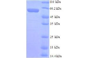 SDS-PAGE (SDS) image for Mdm2, p53 E3 Ubiquitin Protein Ligase Homolog (Mouse) (MDM2) (AA 1-489), (full length) protein (His tag) (ABIN5709925) (MDM2 Protein (AA 1-489, full length) (His tag))