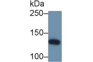 Detection of IRS1 in Bovine Cerebrum lysate using Polyclonal Antibody to Insulin Receptor Substrate 1 (IRS1) (IRS1 Antikörper  (AA 837-1089))