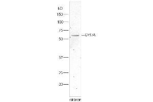 Lane 1:rat brain lysates probed with Rabbit Anti-Cytochrome P450 17A1 Polyclonal Antibody, Unconjugated  at 1:5000 for 90 min at 37˚C. (CYP17A1 Antikörper  (AA 24-65))