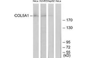 Western blot analysis of extracts from HeLa/HuvEc/HepG2 cells, using Collagen V alpha1 Antibody.