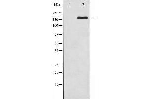 Western blot analysis of Ret expression in K562 whole cell lysates,The lane on the left is treated with the antigen-specific peptide.