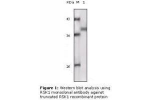 Image no. 2 for anti-Ribosomal Protein S6 Kinase, 90kDa, Polypeptide 1 (RPS6KA1) antibody (ABIN207641) (RPS6KA1 Antikörper)