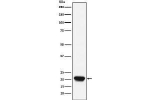 Western blot analysis of RHEB expression in Raji cell lysate.