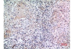 Immunohistochemistry (IHC) analysis of paraffin-embedded Human Lung, antibody was diluted at 1:100. (MCM7 Antikörper  (Internal Region))