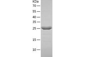 Western Blotting (WB) image for Abhydrolase Domain Containing 10 (ABHD10) (AA 53-306) protein (His tag) (ABIN7121635) (ABHD10 Protein (AA 53-306) (His tag))