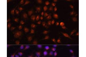 Immunofluorescence analysis of HeLa cells using RAB11A Polyclonal Antibody at dilution of 1:100. (RAB11A Antikörper)