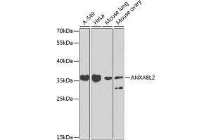 Western blot analysis of extracts of various cell lines, using L2 antibody (ABIN6129912, ABIN6136940, ABIN6136941 and ABIN6223557) at 1:1000 dilution. (ANXA8L2 Antikörper  (AA 1-276))