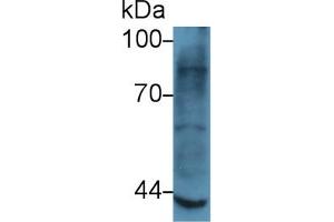 Western Blot; Sample: Rat Skeletal muscle lysate; Primary Ab: 5µg/ml Rabbit Anti-Human MMP3 Antibody Second Ab: 0. (MMP3 Antikörper  (AA 363-477))